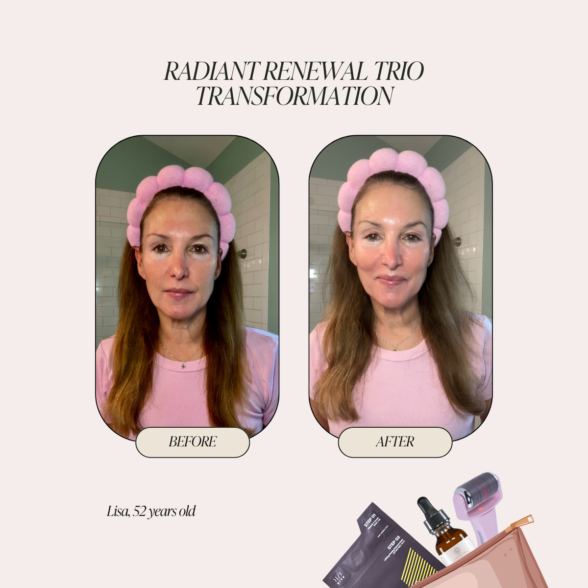 Radiant Renewal Trio